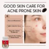 skincare (3) Astalive Astaxanthin 4mg – For Skin Care & Beauty from Within